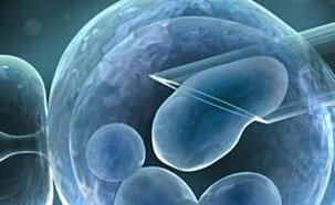 试管混血儿优缺点分析，落户难只是其中一项